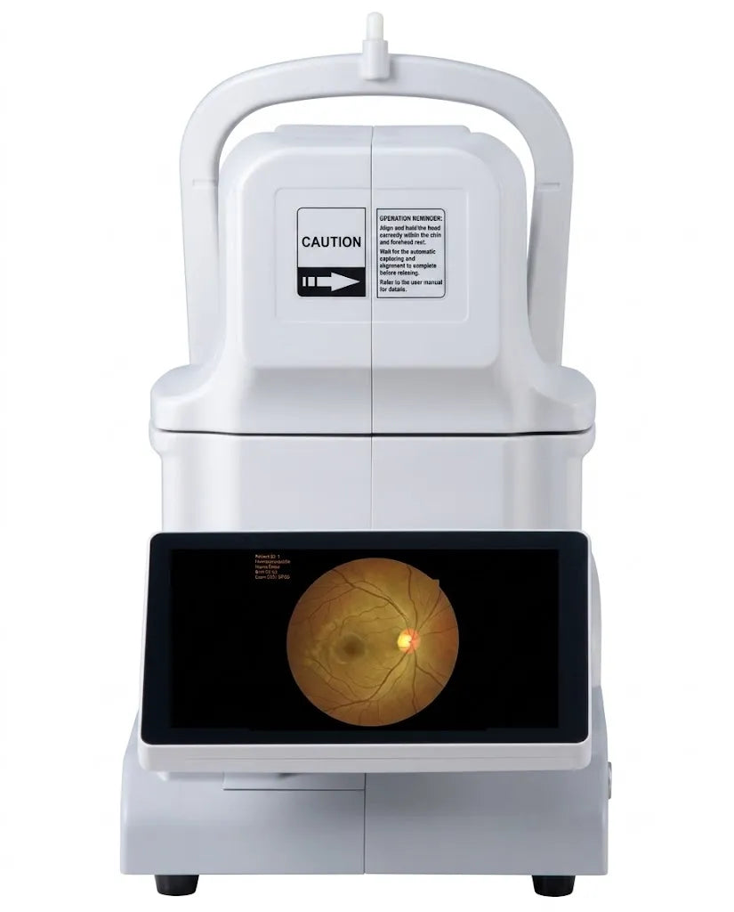 Front view of the DrTono Vista Station automated fundus camera with a retinal image displayed on the built-in screen.