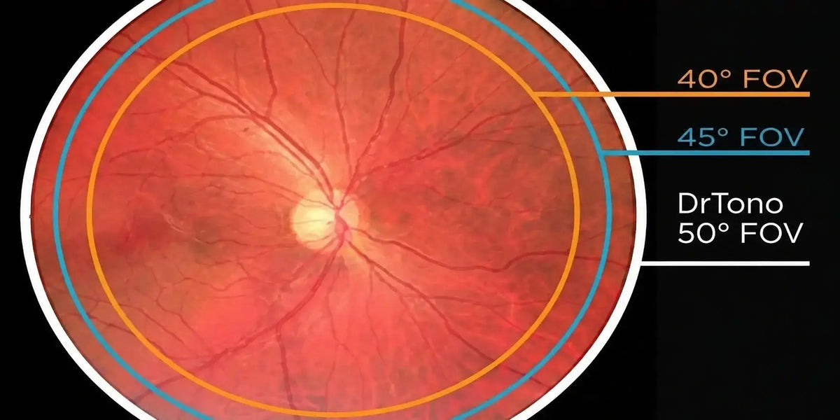 Wide Field Retinal Imaging