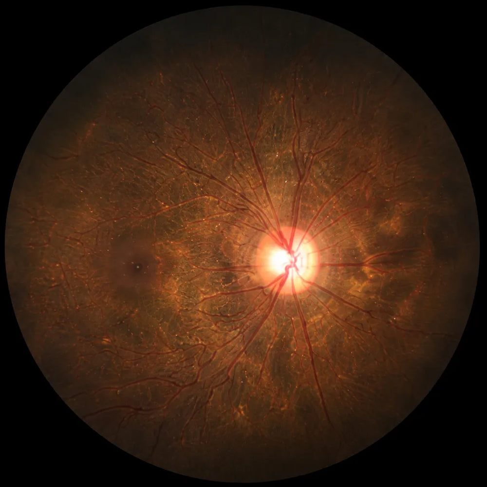 Fundus Image