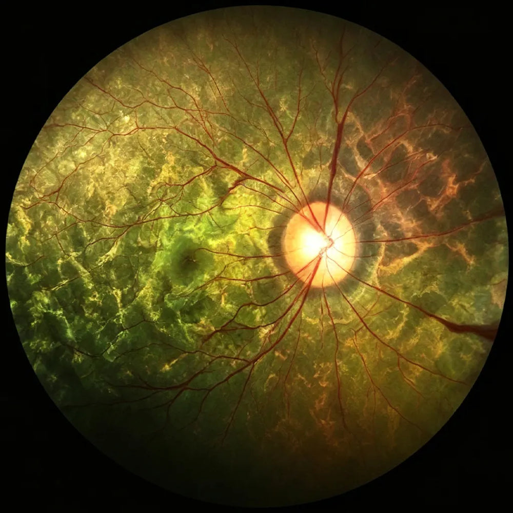 Fundus Image