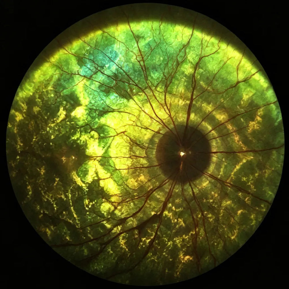 Fundus Image