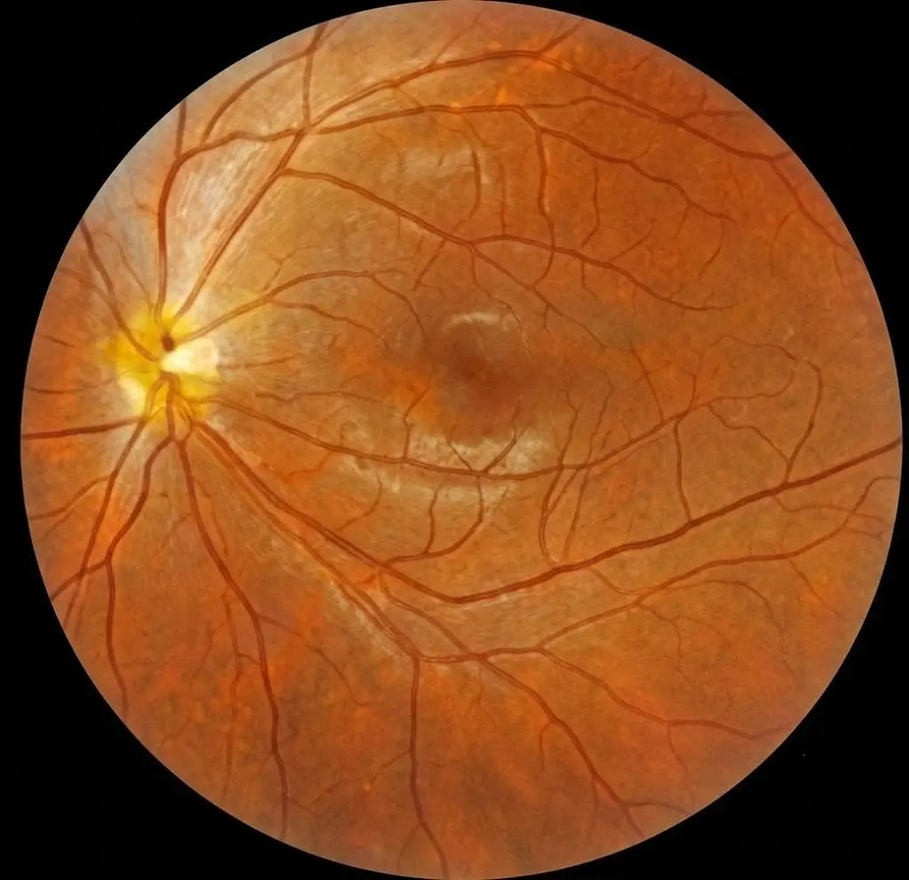 Fundus Image