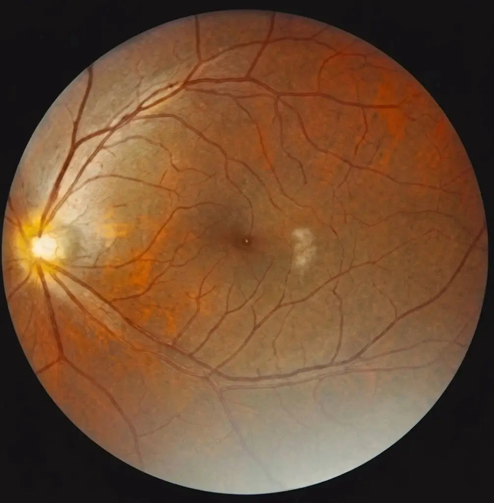 Fundus Image