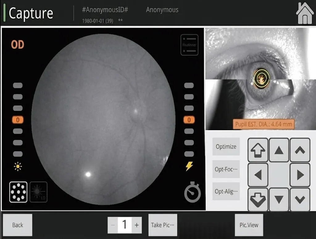 Non-Mydriatic Small Pupil Screening