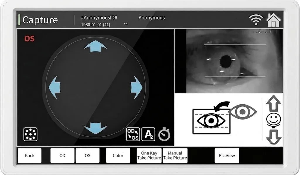 Auto-Tracking & Smart Alignment