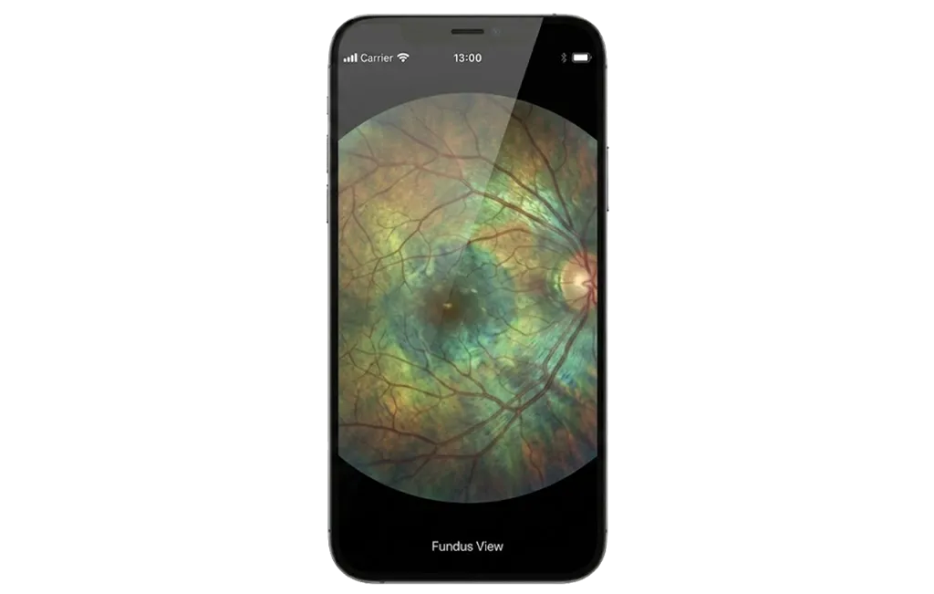 Wireless Image Transmission