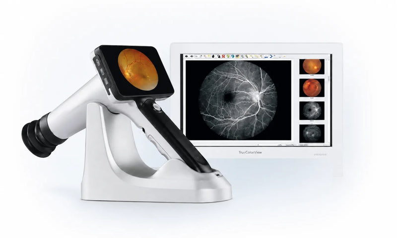 See the retina, unmistakably.